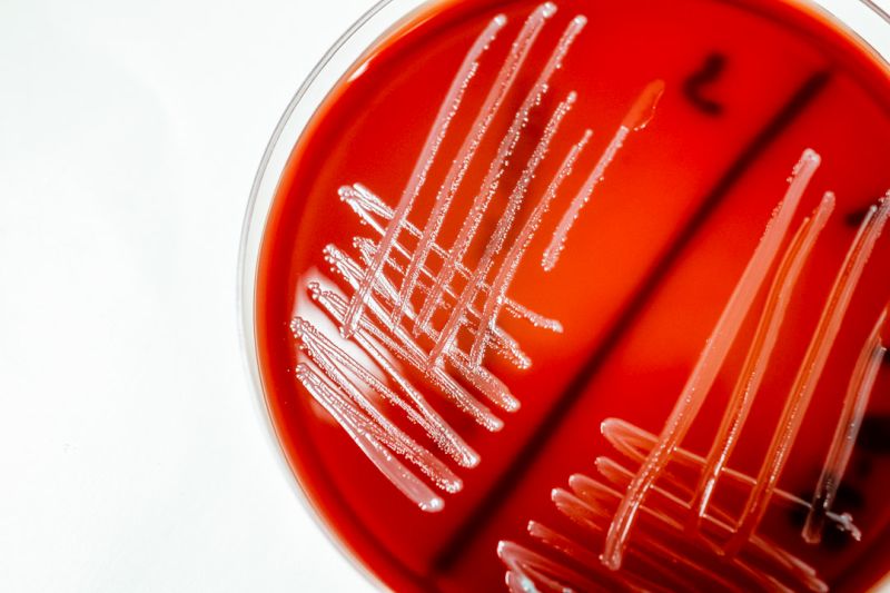 Listeria monocytogenes houdbaarheidsstudie levensmiddelen