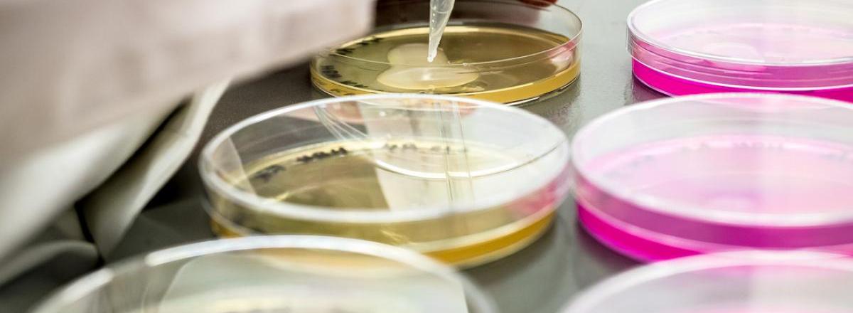 Voor risicomanagement voedselveiligheid, moet je bij smartfood R&D zijn