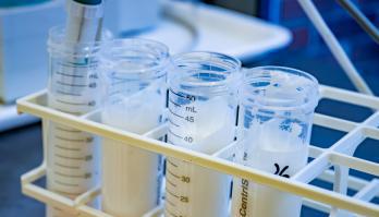 Smartfood R&D prepares for sustainable growth by optimising business processes