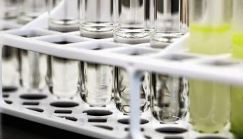 Team Smartfood R&D welcomes new microbiology analyst