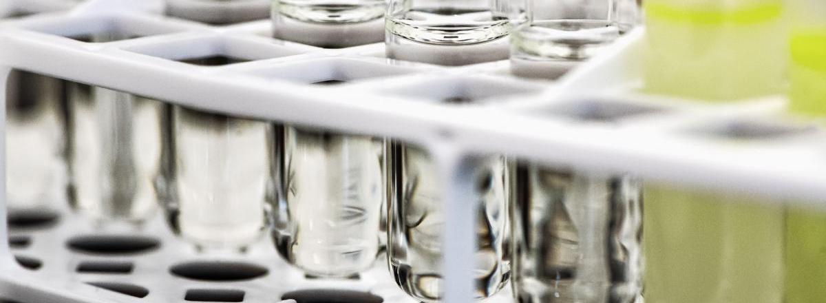 Team Smartfood R&D verwelkomd nieuwe analist microbiologie